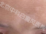 пưҽԺ
