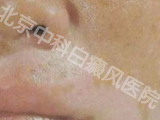 пưҽԺ